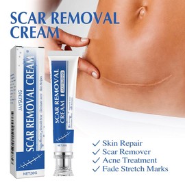 Jaysuing Scar Cream, Scar Smoothing Firming Skin Fading Postoperative Scar Scar Scar Repair Cream Healthcare Therapeutic