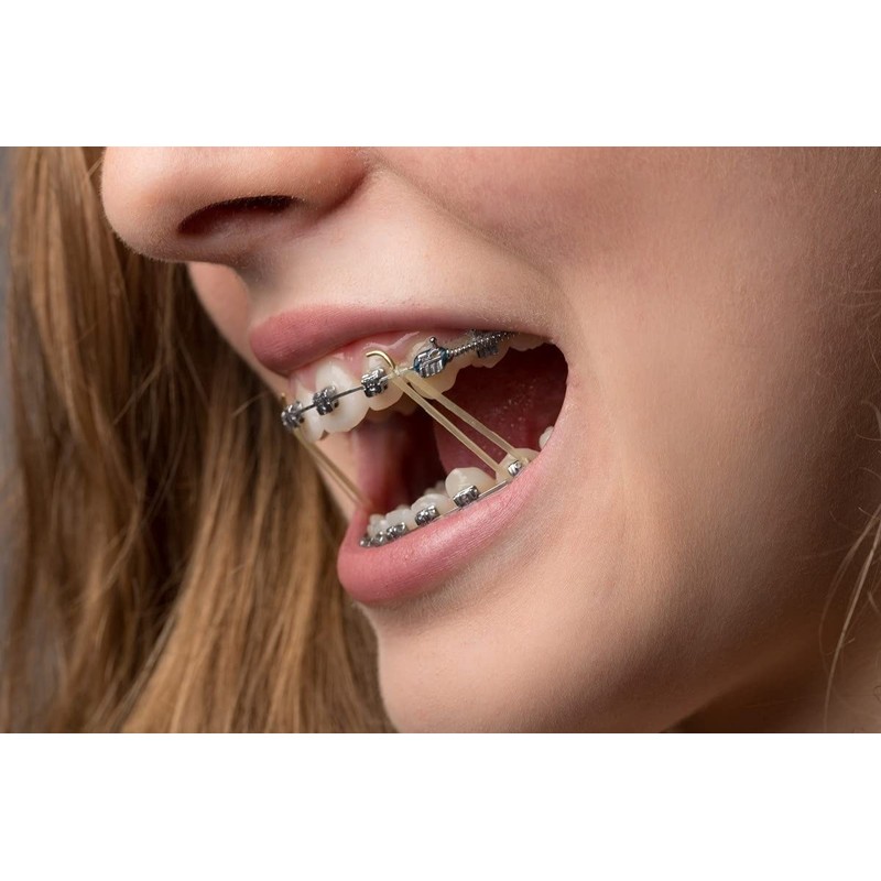 500 Pcs Orthodontic Elastic Rubber Bands, 3.5 Ounces Heavy Dental
