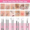 Fangze Blackhead Remover Tool Kit - 6pcs Pimple Popper Tool