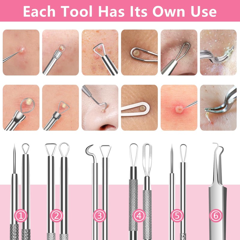 Fangze Blackhead Remover Tool Kit - 6pcs Pimple Popper Tool