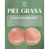 Kit Ácido Hialurónico+cremahumectante+serum Piel Grasa 7pza