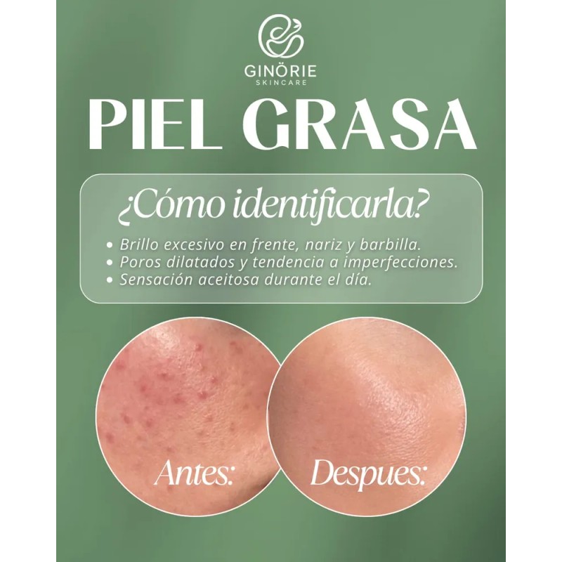 Kit Ácido Hialurónico+cremahumectante+serum Piel Grasa 7pza