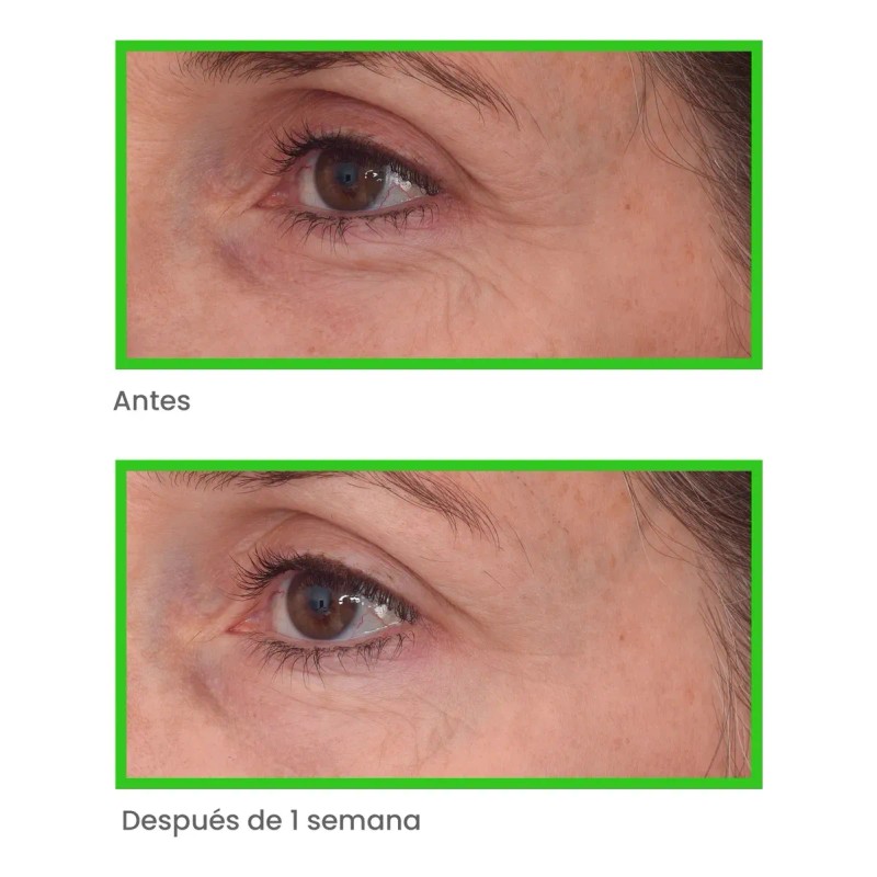 Murad-tratamiento Antiedad Para Ojos Con Retinal 15ml Todo Tipo De