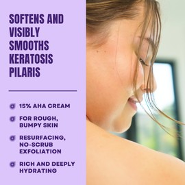 AmLactin KP Bumps Be Gone - 3 oz Keratosis Pilaris Moisturizing Cream with 15% Lactic Acid - Exfoliator and Moisturizer for Dry, Rough and Bumpy Skin, Pack of 2 (Packaging May Vary)