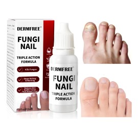 Fungicida Para Uñas Con Hongos, Amarillas,engrosadas Y Duras