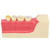 Right Lower Posterior Tooth Model 2X Magnification Detachable Resin Tooth
