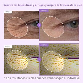 TOSOWOONG Bakuchiol Cápsula Crema, Bakuchiol de Alta Pureza 5,000ppm, Alternativa al Retinol para el Cuidado de Arrugas, Hidratante Reafirmante Antienvejecimiento, 12 Péptidos, 3 Ceramidas, Cuidado de