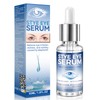 Blepharitis Treatment Serum 30ml, Natural Stye Eye Treatment with Hyaluronic