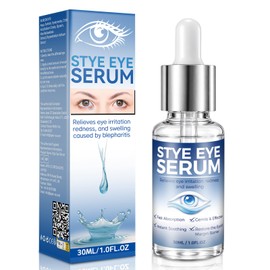 Blepharitis Treatment Serum 30ml, Natural Stye Eye Treatment with Hyaluronic Acid & Aloe Vera, Quickly Soothes Eye Irritation and Redness