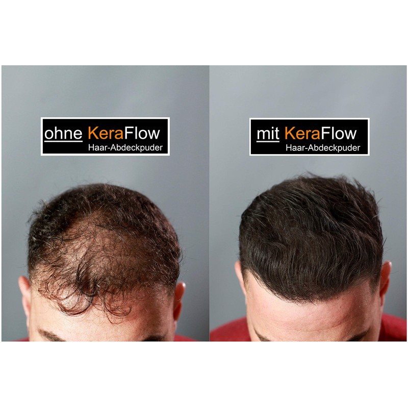 KeraFlow Ansatzpuder, Haar MakeâUp zur Haarverdichter, Haarpulver zum Kaschieren von