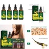 Magik 4-8 Pack Ginger Hair Growth Serum Germinal Oil Regrow