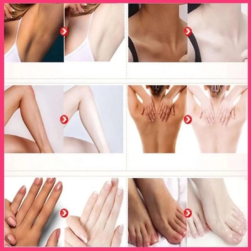 Crema Aclaradora De Axilas Para Mujeres Con Ácido Kójico Par