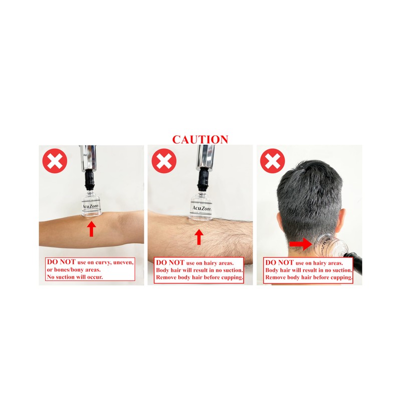 AcuZone Premium 19 Pcs Plastic Cupping Set with Extension Tube