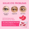 QUIYUM Watermelon Niacinamide Lip & Eye Mask Set, Facial Skincare(12