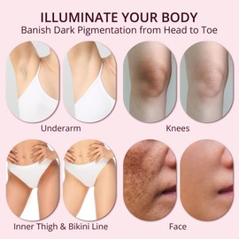 ABERA Dark Spot Corrector Cream for Face, Body & Sensitive Areas, Dark Spot Remover with Arbutin & Niacinamide, Even Skin Tone,1.7 Oz, Set of 2