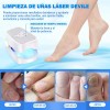 Tratamiento Láser De Hongos En Las Uñas Y Onicomicosis