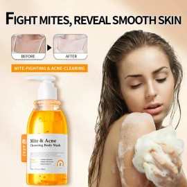 Hz El Gel De Baño Para Eliminar Ácaros Para El Acné Afaj Ot 3963962591597