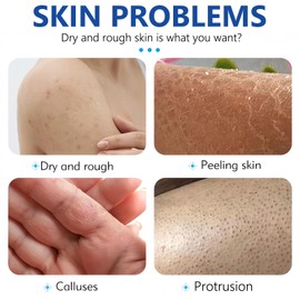 2PCS Wormeer Urea Cream for Feet, New Urea Foot Cream & Heel Balm for Cracked Heels and Dry Skin, Heel Balm for Cracked, Foot Moisturiser