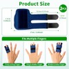 2PCS Finger Splint Trigger Finger Splint with 2 Aluminum Support