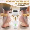 Electric Callus Remover for Feet – 5W Electric Foot Filer,