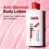 Loción corporal antimanchas TIAM cuidado del acné 6,76 fl oz
