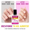 Alisyevaho Stop Nail Biting Treatment for Kids 3+, Thumb Sucking
