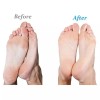 Emjoi 마이크로-페디 호환 SoftFLEX 기술 리필 롤러 (초굵기) - 4개