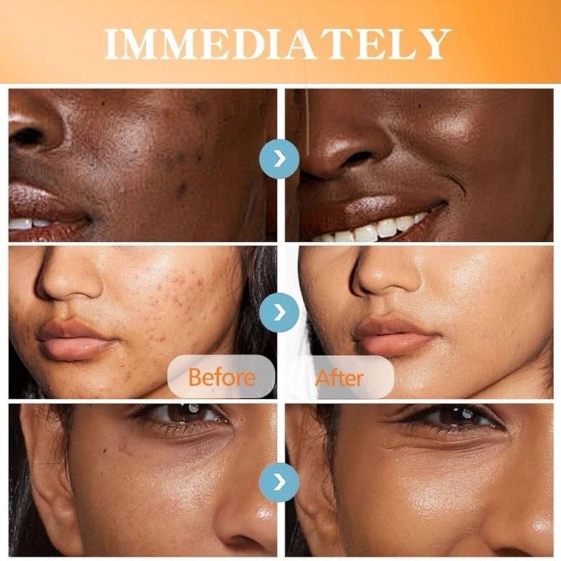 rubriel Turmeric Lotion for Spots, Natural Turmeric Skin Cream for
