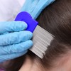 Pack of 2 Lice Comb, Metal Teeth Lice Comb, Double-Sided