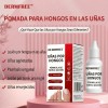 Solución Antifúngica Para Uñas, Pies Y Manos 15 Ml Blanco