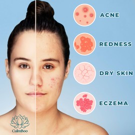 CulmBoo, Hypochlorous Acid Spray for Face & Skin - Acne Prone Skin, Eczema, Natural Tattoo Aftercare, Piercing Aftercare Spray, Eye Lash Cleanser, Face Mist Toner, Wound Care Cleanser, 16 Fl Oz 1 Pack