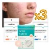 Set 3 Paq Parches Dia/ Noche Quita Espinillas Tapa Acne