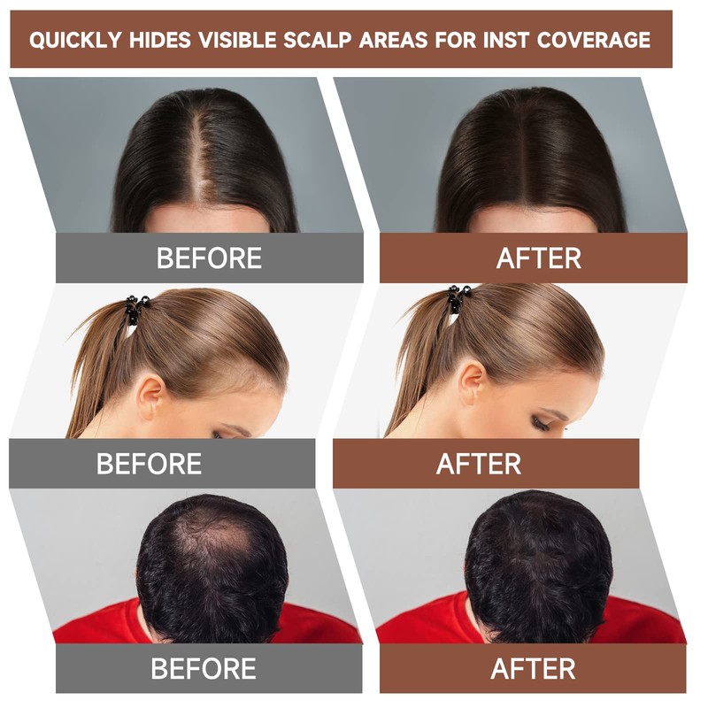 MIFELOY Roots Coverage Powder for Thinning Grays Hairline, Root Cover