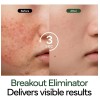 Ivoskin Crema Coreana Reparadora Intensiva De Cica Acn Sensible Danoche