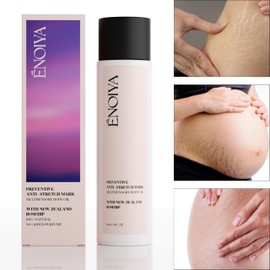 Anti-Stretch Mark Body Oil 150ml - With Organic Rosehip Oil - Prevents, Treats and Reduces Stretch Marks - 100% Natural - With High Quality Essential Oils