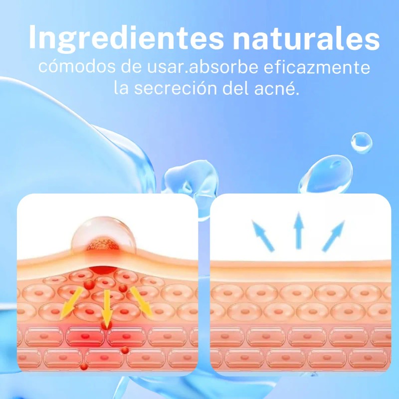 280pzs Mascarillas Estrella Acne