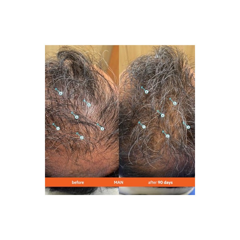 Revita Stimulating Shampoo