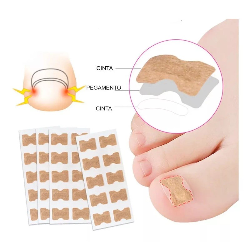 Universo en Linea 50 Parches Correctores Uñas Enterradas Uñeros Adhesivos