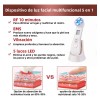 Radiofrecuencia Facial Electroporador Ems Rejuvenece Arrugas Blanco