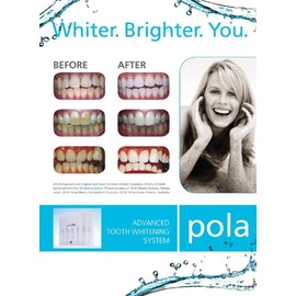 Poladay 6% Hydrogen Peroxide 4 x 1.3gram Whitening Gel Syringe Kit | Shade Guide and Instructions