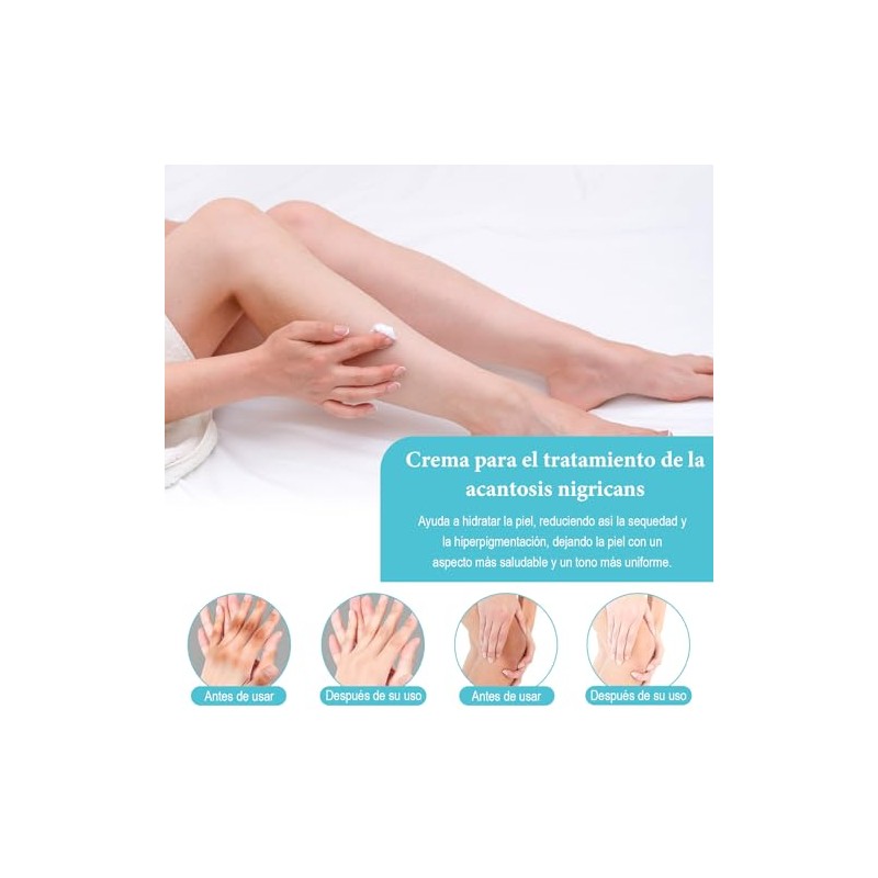 Pcs Acanthosis Nigricans Crema Mejora Pigmentación Unifica Tono Piel Hidrata