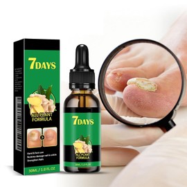 Nail Treatment, Ginger Nail Treatment, Ginger Nail Growth Serum, Nail Nutrient Strengthener Oil - Ginger Cuticle Care Oil for Nails 2Pcs