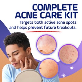 Asepxia Acne Care Set - Charcoal Cleansing Bar Soap for Acne and Blackheads + Acne Spot Treatment Cream with 10% Benzoyl Peroxide - Removes Impurities, Helps Oily Skin - 4 Oz Soap, 1 Oz Cream