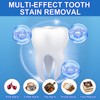 9D Teeth Whitening Strips 14 Treatments, Enamel Safe, Whitening Teeth