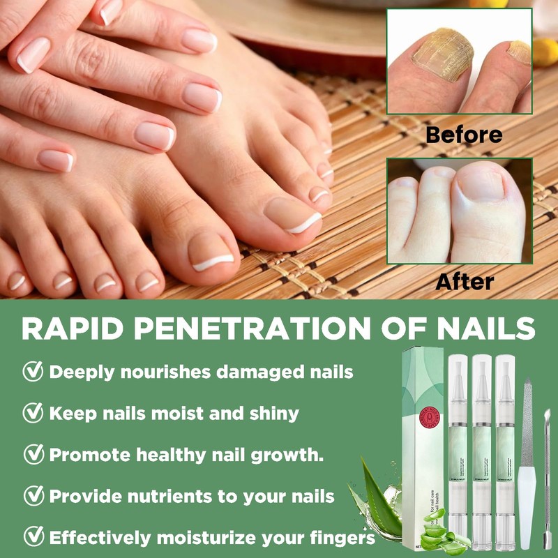 Pack of 3 Nail Care with Tea Tree Oil, Vitamin