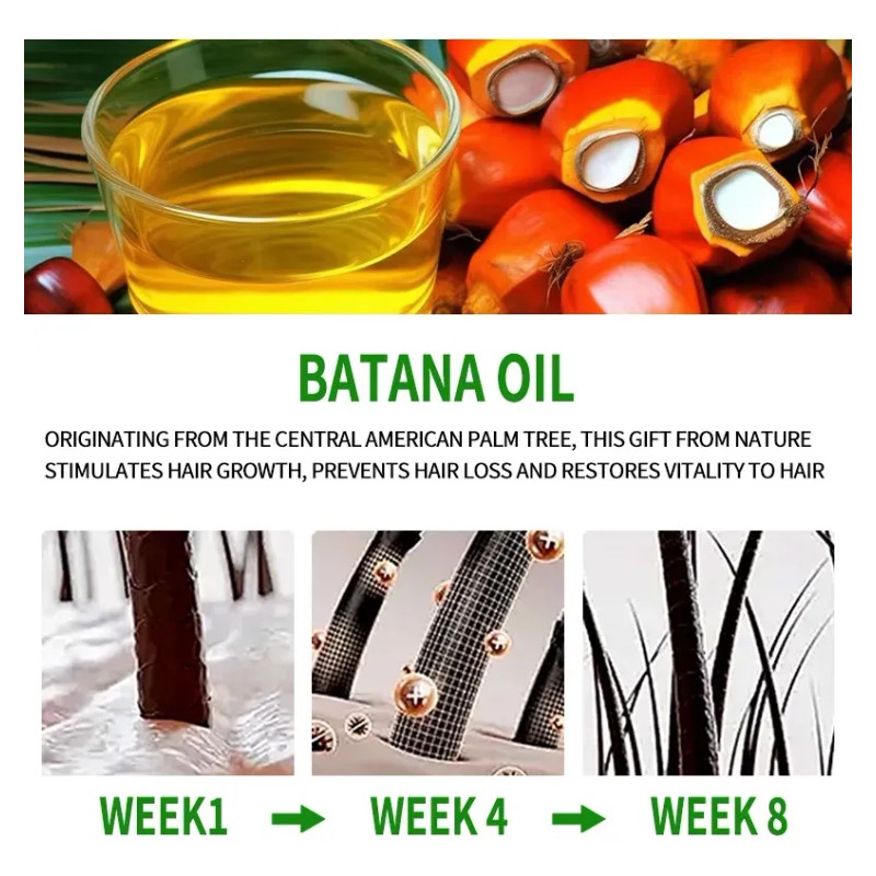 2026 Aceite De Batana Para Cabello Nutre Y Suaviza 30ml