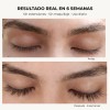 B-lashes Suero Crecimiento Pestañas Largas Origen Natural