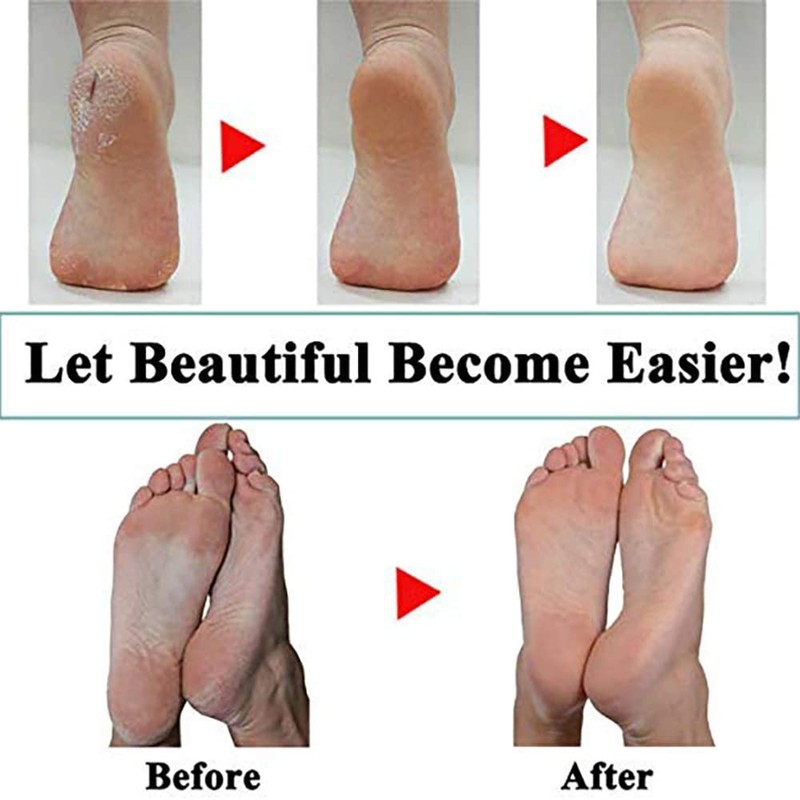 Hsthe Sea 4 Pack Extra Coarse Mineral Replacement Rollers Mineral