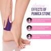 Glamza Foot Pumice Sponge Callus Exfoliate Stone Hard Skin Remove
