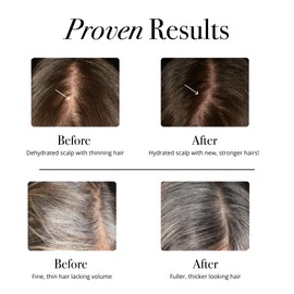 Glotrition HairRx Gummies – Hair Growth Gummy for Women – Powerful Hair chew for Women & Hair Vitamins for Stronger, Thicker Hair & Healthy Skin – 60 Vitamin Gummy